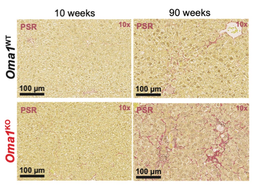 OMA1 protege de la fibrosis hepática durante el envejecimiento en ratones.