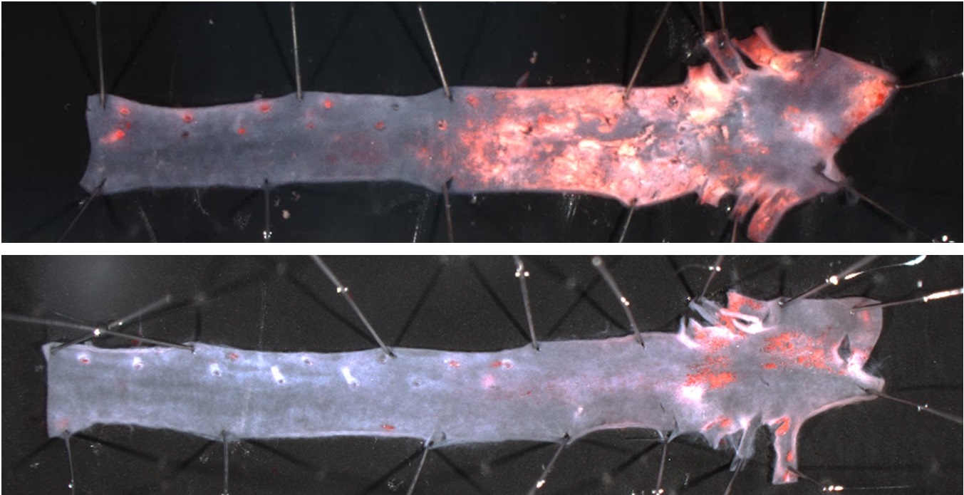 El desarrollo de aterosclerosis exacerbada en la aorta de ratones progeroides (imagen superior) se previene al eliminar progerina en las células de músculo liso vascular (imagen inferior).