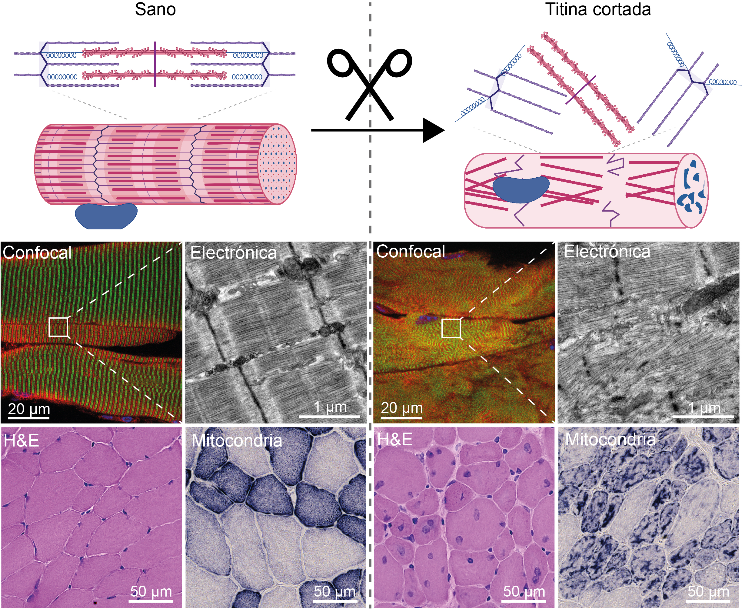 TEVs-TTN es una herramienta que permite el corte controlado de titina en ratón. Las imágenes de microscopía confocal y electrónica muestran que el corte de titina en músculo desencadena un desensamblado de los sarcómeros y las imágenes de histología con coloración hematoxilina-eosina (H&E) y succinato deshidrogenasa (SDH) evidencian la atrofia de las miofibras, la internalización de sus núcleos y la agregación de sus mitocondrias. Creado parcialmente con BioRender.com