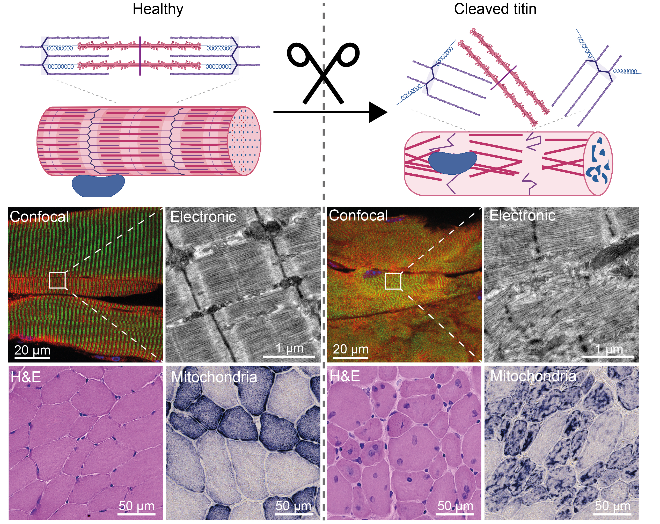 TEVs-TTN is a tool that permits the controlled cleavage of titin in mice. The confocal and electron microscopy images show that titin cleavage in muscle triggers disassembly of sarcomeres, and the staining with hematoxylin and eosin (H&E) and succinate dehydrogenase (Mitochondria) reveal myofibril atrophy, nuclear internalization, and mitochondrial aggregation. Image partially created with BioRender.com