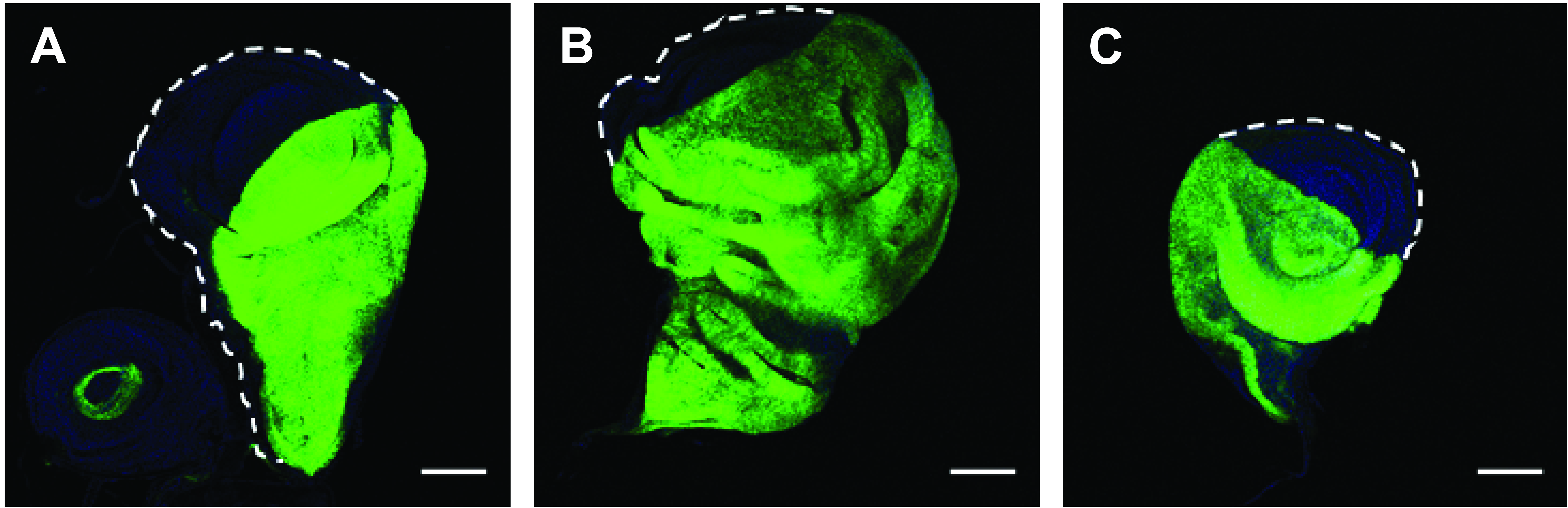 Bloquear Importina-7 permite controlar el tamaño de un órgano. Panel A: Órgano de la mosca de la fruta Drosophila melanoganster normal. Panel B: Órgano sobrecrecido debido a una activación y acumulación de YAP en el núcleo. Panel C: Órgano en el que se ha bloqueado el sobrecrecimiento mediante la inhibición de la lanzadera Importina-