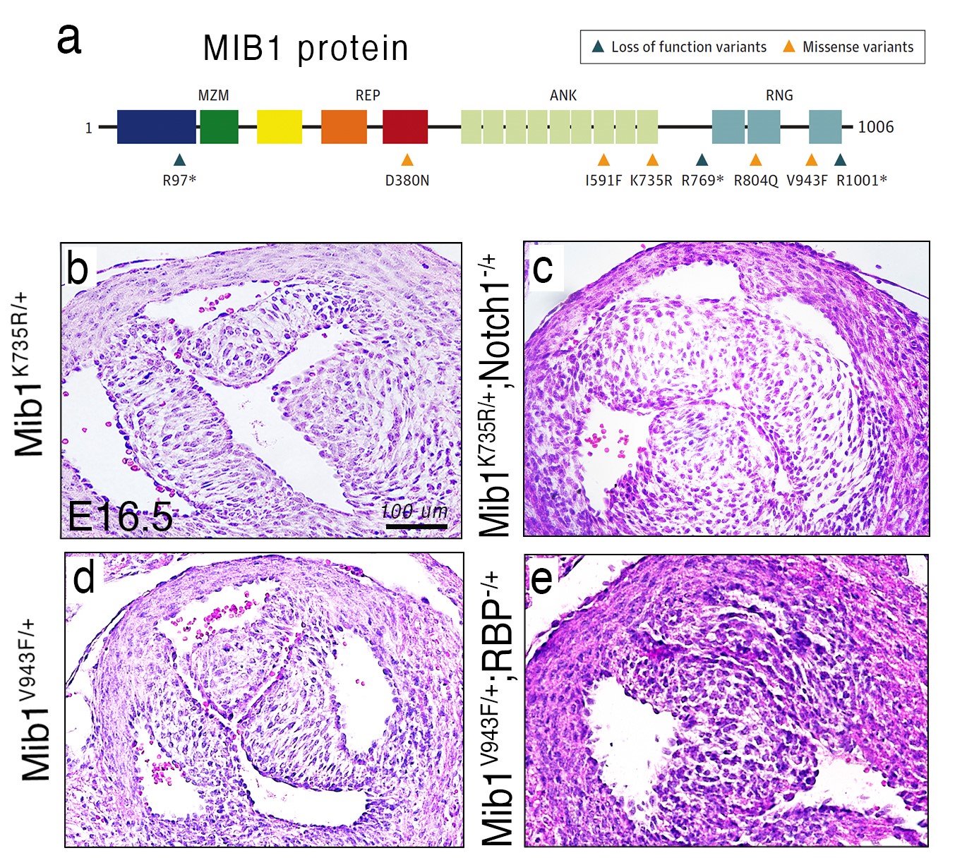Mutaciones en MIB1 asociadas a la presencia de BAV,  cuyo modelado en ratón causa BAV. (a) Esquema de la proteína MIB1 con sus distintos dominios funcionales y las mutaciones identificadas asociadas a BAV familiar y esporádica. La generación mediante edición genética de dos líneas de ratón portadoras de mutaciones que afectan a la función de MIB1 (MIB1K735R y MIB1V943F) causa el desarrollo de una BAV.  
