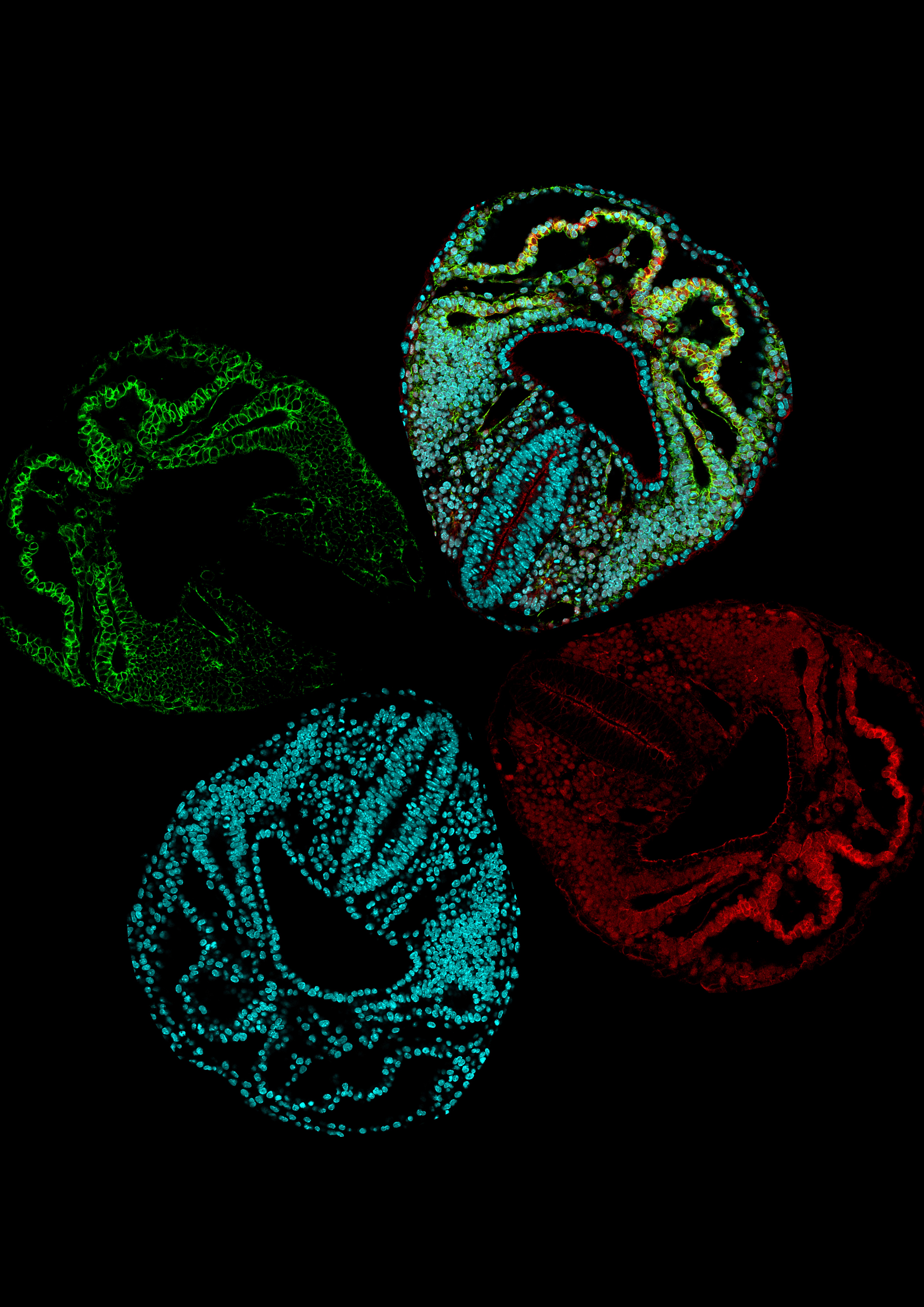 La imagen muestra una sección óptica de una vista ventral de un embrión de ratón en el día embrionario E8.0. En verde la membrana de las células mesodérmicas, rojo las células transgénicas positivas de tomate y azul los núcleos.