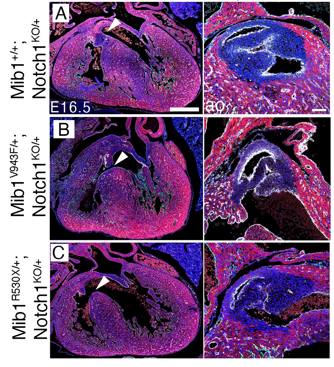 Distintos genes modificadores determinan el efecto de dos mutaciones causantes de miocardiopatía