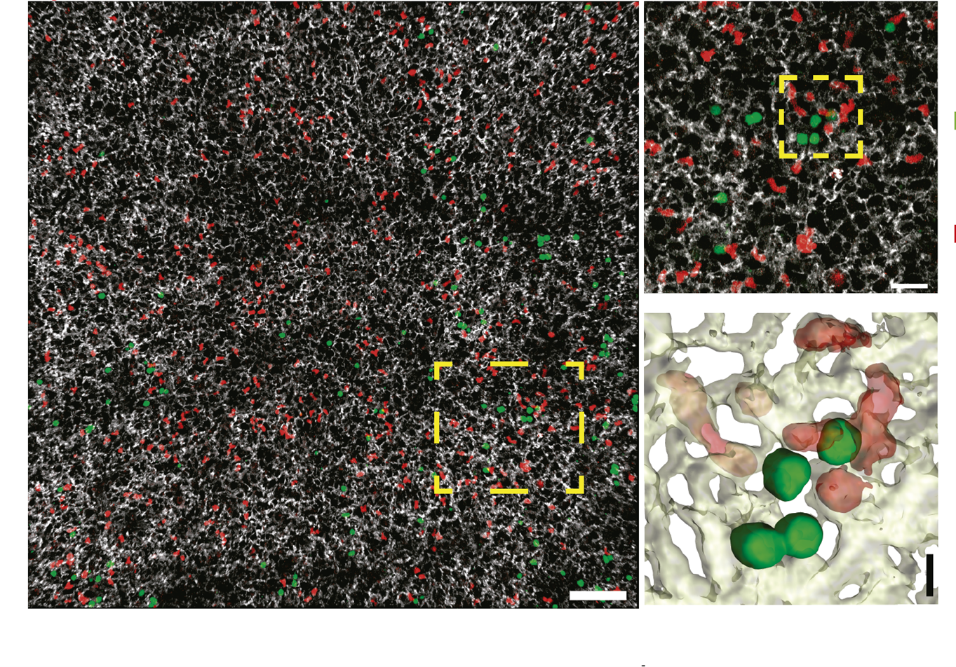 Neutrophils in the lung