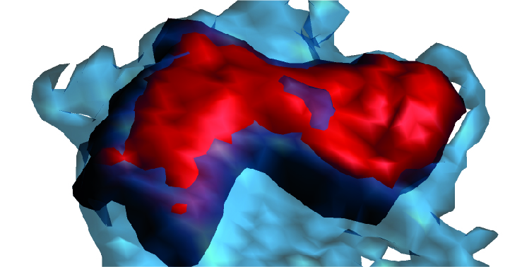 Imagen 2: Neutrófilo con comportamiento asociado daño cardiovascular.