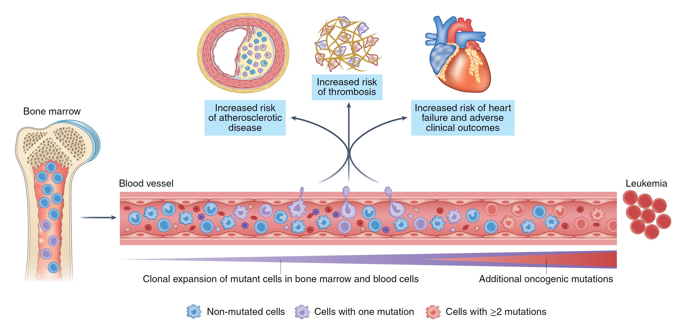 Mutaciones en células sanguíneas contribuyen al desarrollo de enfermedad cardiovascular.