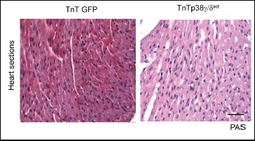 La expresión temprana de p38g/d produce una reducción del glucógeno cardiaco