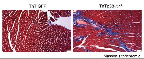 Los corazones que tienen un déficit energético con el tiempo desarrollan fibrosis y disfunción cardiaca.