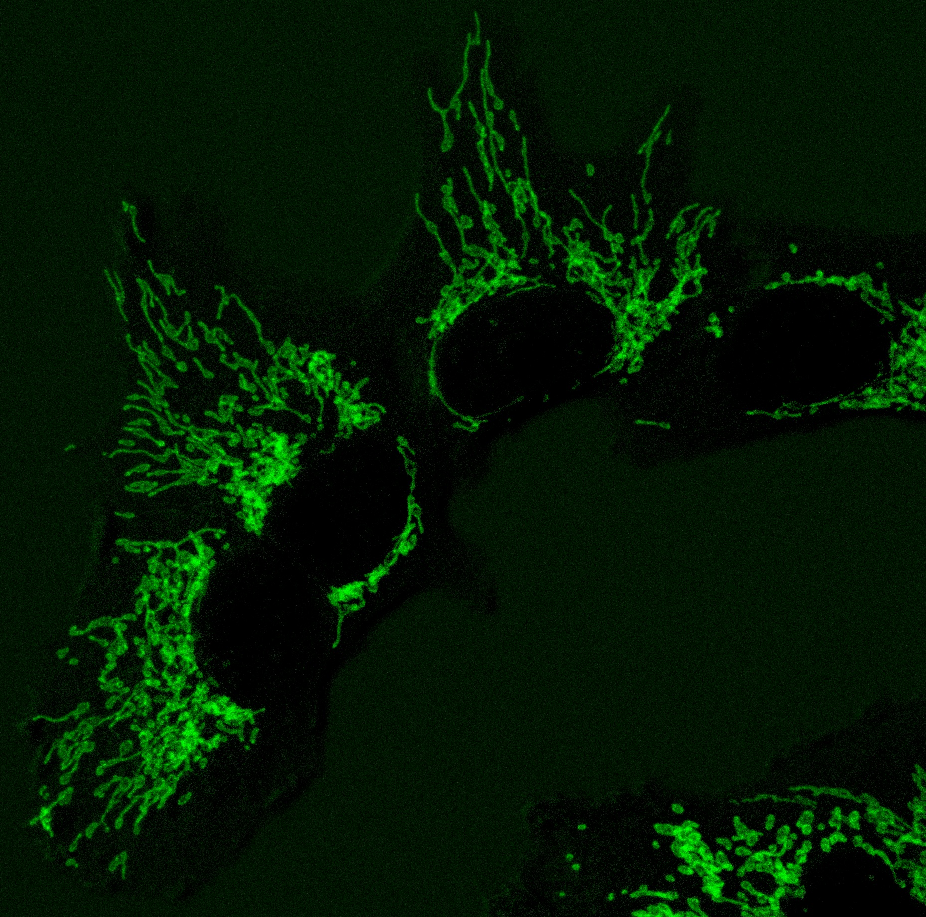 Imagen Imagen de microscopía de fluorescencia de las mitocondrias en células humanas sanas, que ayudan a producir los componentes básicos del ADN.