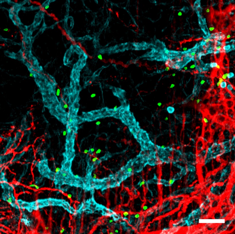 : Neutrophils (green) in the intestinal mucosa, close to neurons (red) and blood vessels (blue).