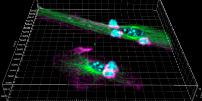 Generación de células dendríticas post-sinápticas. La imagen muestra los contactos intercelulares entre las células dendríticas  y los linfocitos T. Células Dendríticas (verde) y los linfocitos T (azul y rosa)