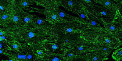 Microfotografía de una monocapa de cardiomiocitos derivados de células madre inducidas a la pluripotencia, representativa de las que se usaron para estudiar los mecanismos de arritmias y el rescate de la función normal por el gen que codifica a la sintrofina-α