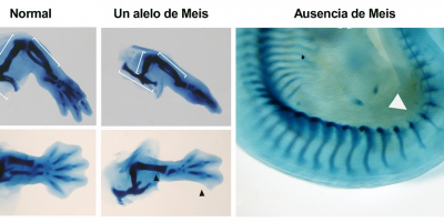 Skeletal staining of the inferior limb regions of normal embryos, embryos with a single Meis allele, and an embryo with complete absence of Meis. Embryos with a single copy of Meis lack the fibula and posterior digits (black arrow). Total absence of Meis prevents limb development (white arrow).