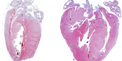 Imagen de histología que muestra la comparación del tamaño del corazón de un ratón normal (izquierda) y un ratón deficiente para la proteína MKK6 (derecha). 