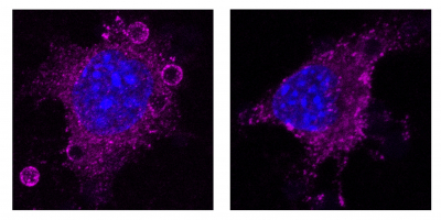 Fibroblasto embrionario murino Cav1KO (izquierda, sin caveolas) muestra un mayor reclutamiento de integrina beta 1 activa (magenta) en torno a bolitas recubiertas con fibronectina, en comparación con un fibroblasto embrionario murino Cav1WT (derecha, con caveolas).
