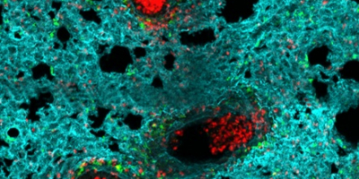 Foto Neutrophils (red) accumulate in the alveoli of a flu-infected lung