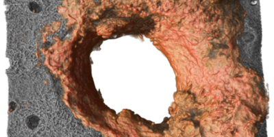 3D reconstruction of the collagen ring (in orange) produced by neutrophils, which forms around wounds in the skin.