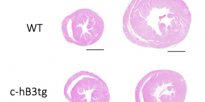 Cortes transversales de corazones de ratones “normales” (WT) y de animales transgénicos que sobreexpresan el receptor Beta3adrenérgico (c-h3tg) 3 meses después de haberlos sometido a una estenosis aórtica (TAC) donde se puede observar una menor hipertrofia secundaria al TAC en los ratones transgénicos. 