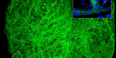 Neuregulin-1 induces changes in actin filaments during ventricular maturation. Actinin staining of a mouse embryo heart reveals a striated actin pattern corresponding to mature trabecular sarcomeres (green). The magnified view shows the differences in luminosity that distinguish the more organized actin filaments of the trabecular myocardium from the less organized compact layer