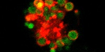 Microscopía confocal mostrando un macrófago peritoneal de un ratón deficiente en RXR, donde se observa un alto contenido de lípidos (verde) dentro de vesículas ácidas (rojo).