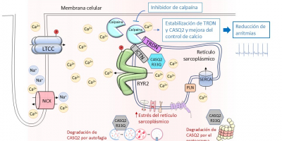 La mutación R33Q en la calsecuestrina 2 (CASQ2) altera el control del calcio en las células del corazón y activa mecanismos de degradación de proteínas.