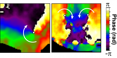 Imágenes de mapeado óptico de dos corazones distintos de ratones que desarrollaron fibrilación ventricular.