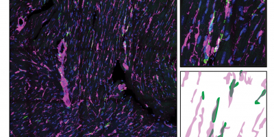 Las imágenes muestran macrófagos (verde) en estrecho contacto con fibroblastos (magenta).