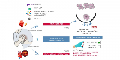 First biomarker in blood that distinguishes myocarditis from an acute myocardial infarction