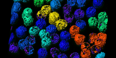 Proteína HS1 en células B humana determinada con Nanoscopía 3D-STED @CNIC