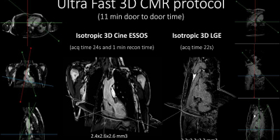 Visualización 3D de los estudios de anatomía, función y caracterización tisular adquiridos con el protocolo utra-rápido.