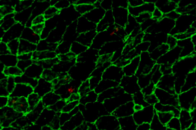 La imagen muestra monocitos patrulleros (en rojo) adheridos al endotelio inflamado (en verde) de la curvatura menor del cayado aórtico de ratones con aterosclerosis incipiente.
