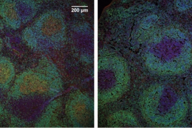 Representative images lymph nodes in a control mouse (left) and a mouse lacking CTCF (right), showing germinal centers in the control mouse (red).