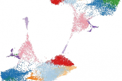 Clasificación automática de células mieloides en zonas clave que mantienen la fibrilación auricular (arriba derecha) y en zonas auriculares alejadas (abajo izquierda). Imagen adaptada espacialmente con fines ilustrativos.