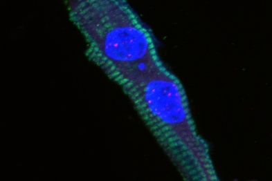 Cardiomiocito postnatal día 8 que contiene un micronúcleo. Azul: DAPI (marcador de ADN); Verde: TNT (marcador de cardiomiocitos); Rojo: PNA-TTAGGG-Cy3 (marcador de los telómeros).