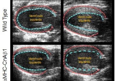  La sobrexpresión de CnAβ1 en cardiomiocitos disminuye la hipertrofia ventricular. La imagen muestra el contorno de la pared del ventrículo izquierdo 21 días después de la constricción de la aorta o una cirugía control. Los ratones que sobrexpresan CnAβ1 en corazón (aMHC-CnAβ1) presentan un menos engrosamiento de la pared del ventrículo.
