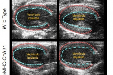 Overexpression of CnAβ1 in cardiomyocytes reduces ventricular hypertrophy. The image shows the inner and outer outlines of the left ventricular wall 21 days after aortic constriction or control surgery. The mice overexpressing CnAβ1 in the heart (aMHC-CnAβ1) show less ventricular wall thickening. 