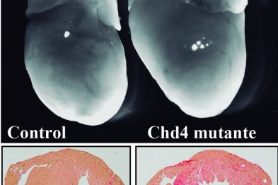 Imágenes de corazones control y deficiente en Chd4 (arriba). Abajo se muestran imágenes de cortes histológicos donde se observa la acumulación de fibrosis intersticial aguda (en rojo) en el corazón mutante (abajo).