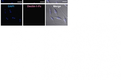 Imagen obtenida por microscopía confocal donde puede observarse la el material genético de parásitos Leishmania major (DAPI), así como la tinción con una proteína recombinante que contiene el dominio extracelular de los receptores Mincle o Dectin-1. 