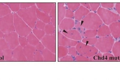 Imágenes de cortes histológicos de músculo esquelético control y deficiente en Chd4. Las flechas indican fibras en regeneración, con el núcleo central.