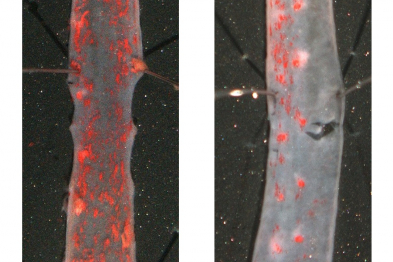 El tratamiento de ratones progéricos con TUDCA ralentiza la progresión de aterosclerosis (visualizada en rojo en aorta torácica).