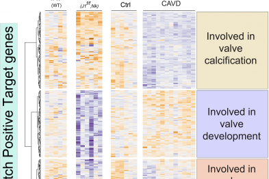 Expresión de genes activados por la vía de Notch en válvulas cardíacas sanas (TAV) y fusionadas (BAV) durante el desarrollo embrionario, y en válvulas adultas sanas (control) y calcificadas (CAVD). Se han identificado genes inhibidos en válvulas adultas calcificadas, en válvulas embrionarias fusionadas y en ambas situaciones.