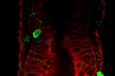 La imagen muestra un embrión temprano de ratón en dónde se pueden ver las células pluripotentes.  