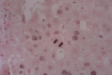  Hepatocitos durante el proceso de la división celular.