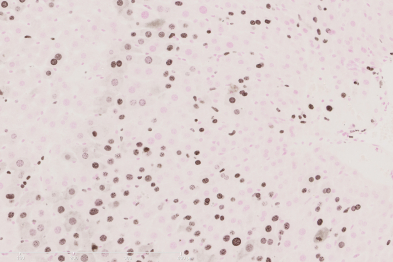 Hígado en plena proliferación (núcleos teñidos de marrón) tras una hepatectomía parcial