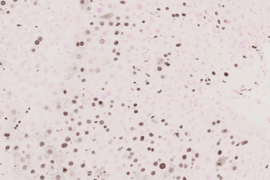 Liver proliferation (Brown-stained nuclei) after partial hepatectomy.