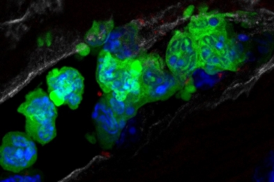 Imagen de microscopía confocal de un corazón post-infarto. Se observa un agregado de neutrófilos (células verdes) obstruyendo la microcirculación del corazón. 