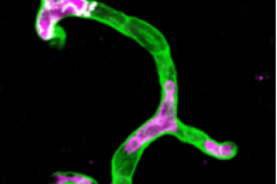 Inmunotrombosis por NETosis intravascular, captada después de un ictus experimental en fase circadiana inactiva, muestra neutrófilos tdTomato⁺ (magenta) liberando trampas extracelulares de neutrófilos (NETs) positivas para histona H3 citrulinada (blanco), que ocluyen los microvasos cerebrales marcados con lectina (verde), ilustrando el marcado impacto de la inmunotrombosis mediada por neutrófilos sobre el flujo microvascular.