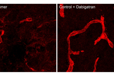 Los vasos cerebrales (rojo) están dañados en los ratones con alzhéimer, pero el tratamiento anticoagulante con dabigatrán previene dicho daño vascular.