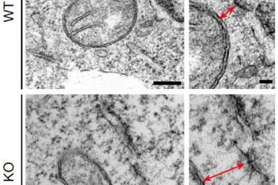 Electron microscopy images showing increased distance between the mitochondria and the nuclear pore complex upon truncation of the pore protein RANBP2.